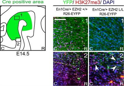 EZH2 Influences mdDA Neuronal Differentiation, Maintenance and Survival